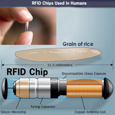 how to identify rfid tracking in body|detecting rfid implants.